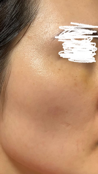 キメについて 美容皮膚科での治療をしようと思っています どこのカ Yahoo 知恵袋