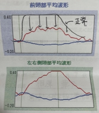 光トポグラフィー検査について先日 心身の調子が悪く心療内科にいきました 話 Yahoo 知恵袋