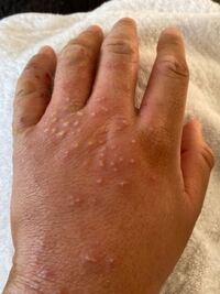 助けてください 写真あり 寝ていたら 左の手がこうなってまし Yahoo 知恵袋