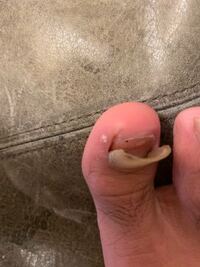 サッカーやフットサルをやっている方に質問です 足先の怪我予防につい Yahoo 知恵袋