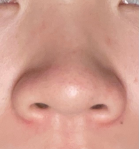 最近鼻の下 あたりの匂いを嗅ぐと臭いです 悪く言えば嘔吐物の匂 Yahoo 知恵袋