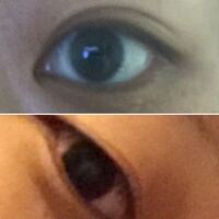 生まれつき腫れぼったい目をしていてる29歳の女です 辛うじて奥二重気 Yahoo 知恵袋