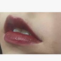 湘南美容クリニックでvioの脱毛をしようかと考えています なんですが Yahoo 知恵袋