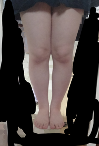 この足太いですか 量産型みたいなふわふわした服を着てみたいのですが 足が Yahoo 知恵袋