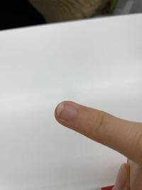 薬指の爪の白い部分が少し変なのですがなんでですか チョッと捲れ気味に Yahoo 知恵袋