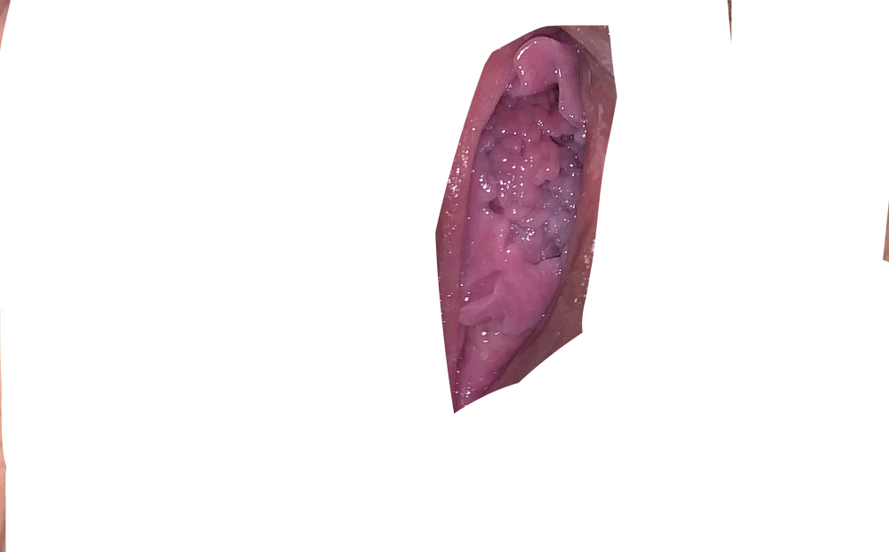 なんとなく自分の性器を見てみたら気持ち悪いくらいにブツブツだらけでした 他 Yahoo 知恵袋