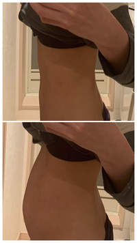 写真注意 お腹の異常な太さについて 小さい頃から ずっと悩み続 Yahoo 知恵袋