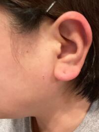 福耳ですか あと ピアスの穴は10代後半に開けましたがまだ Yahoo 知恵袋