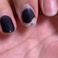 ジェルがいつの間にか剥がれちゃってて 爪の先が黒くなっていたのですが理由わ Yahoo 知恵袋