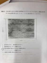 言語聴覚士学生です 国試の模試の解説をお願いしたいです 答えは３ Yahoo 知恵袋