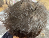 子供の髪の毛が鳥の巣状態で困ってます １歳半の娘が Yahoo 知恵袋