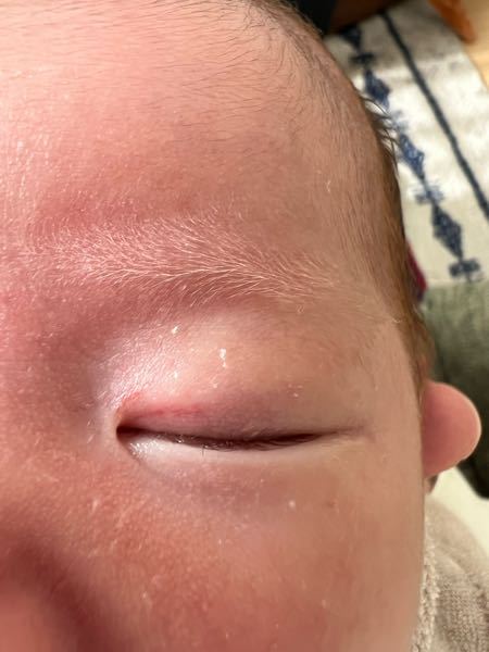 子どもの病気とトラブル 解決済みの質問 Yahoo 知恵袋
