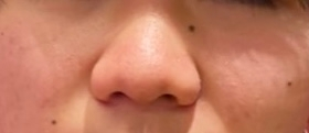 このように鼻がでかいのがコンプレックスなのですが、どうしたら小さくできますか？ 整形以外でお願いしたいです