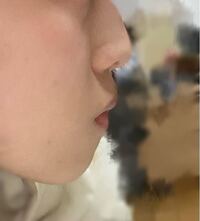 高校生2鼻が低すぎて自分のことが大嫌いです 口元も輪郭も嫌いですが 特に鼻 Yahoo 知恵袋