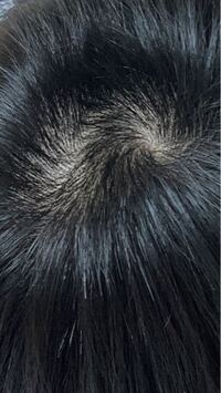 自分には2つつむじがあるのですが これはつむじハゲって言うんです Yahoo 知恵袋