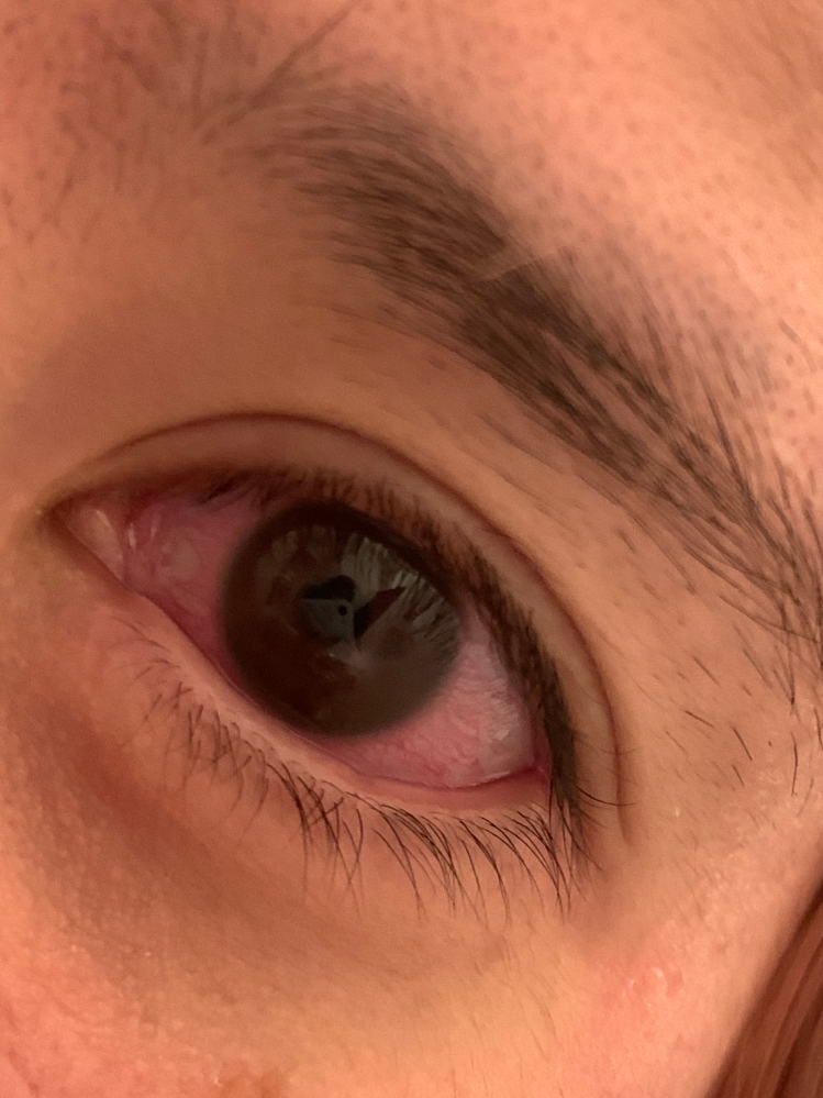 角膜炎になり、約10日経つのですが黒目に白い傷が見えるようになりました。 調べると失明などと出てくるのですが大丈夫でしょうか？