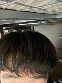雨の日とか良く髪の毛うねるんですけど 普通の時でもうねうね Yahoo 知恵袋