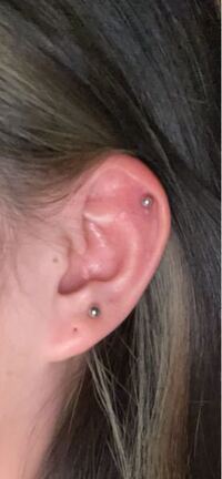 この軟骨の位置はヘリックスですか それともアウターコンクですか ヘリ Yahoo 知恵袋