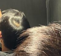 至急これってつむじなんですか 高校生です Yahoo 知恵袋