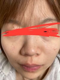 28歳です 肌のたるみが酷く 40代に間違われるのをせめて年相応に Yahoo 知恵袋