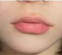 唇の形がコンプレックスです 上唇が狭くて人中が長く見えてし Yahoo 知恵袋