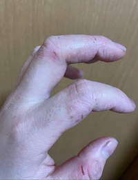 美容師アシスタント3年目なのですがいままで手荒れしてもすぐに治っ Yahoo 知恵袋