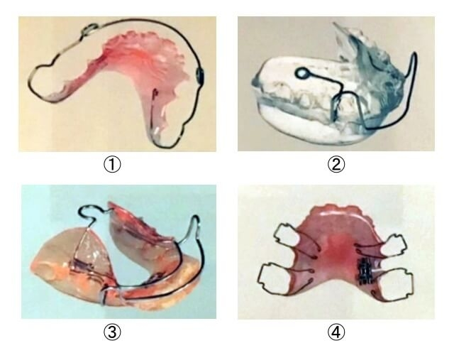 歯科衛生士国家試験の過去問です 写真の と がなんの矯正装置か分からないの Yahoo 知恵袋