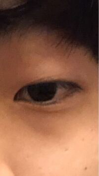 これは青クマか黒クマのどちらでしょうか Yahoo 知恵袋