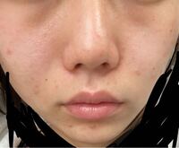 写真ありです。 顔がブスなのですが、とくに目から下がブスです。
整形以外にどうすればよろしいですか？
メイクや、ストレッチとか教えて欲しいです。