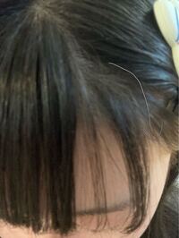 私は生え癖があって 写真のように半分から右が すこんと根元から落ちなくて Yahoo 知恵袋