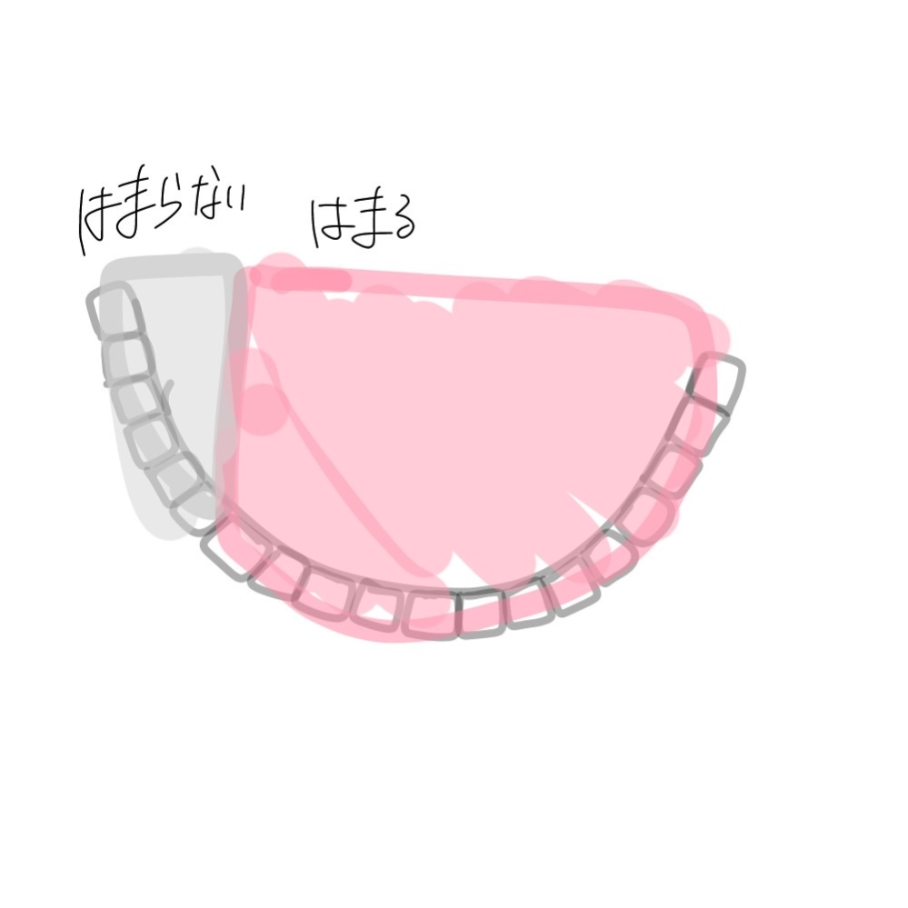 矯正してるんですけどあと数3月つけたら終わるはずだったのに何故かサボってし Yahoo 知恵袋