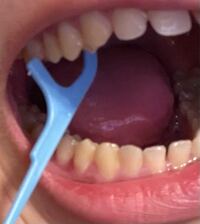 糸ようじが取れなくなりました 助けてください Yahoo 知恵袋