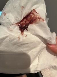 ピルを飲み始めて最初の生理が来たんだと思うのですが 非常に粘り気 Yahoo 知恵袋