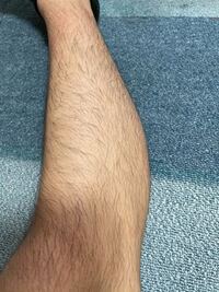 高校生男子です すね毛の量自体は普通だと思うんですが 色が濃いせ Yahoo 知恵袋