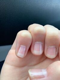 昨日 透明マニキュアを塗ったら 爪の白い部分 が 増えてしまった気がするん Yahoo 知恵袋