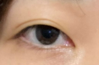 目つきが悪く悩んでいます。
黒目の下に白目はない状態ですが、これは下三白眼なんでしょうか？
それとも眼瞼下垂にあたりますか？ 吊り目が原因かと思い目尻下げるメイクをしても、黒目がこの形だと印象変わらないようです。どなたかアドバイス頂けると嬉しいです。