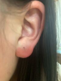 ピアスを開けて2ヶ月たち完全に安定してないのですがど真ん中すぎて少し下に開 Yahoo 知恵袋