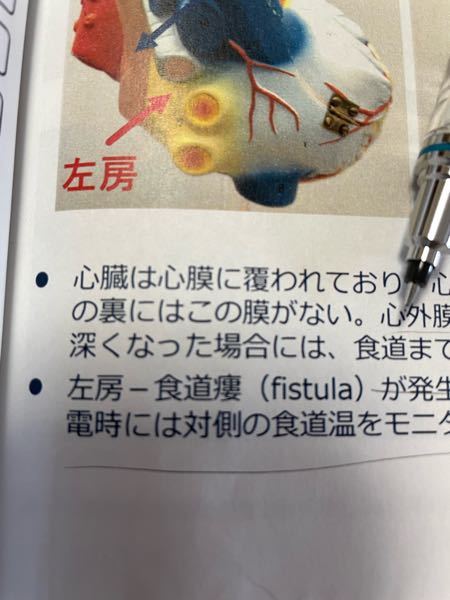 スーパーアーマー状態 を分かりやすく簡潔な表現になるように Yahoo 知恵袋