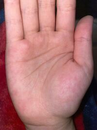 薬指 中指の下にある縦線 頭脳線の左下ら辺にある短い横線 ぐにゃんと曲がっ Yahoo 知恵袋