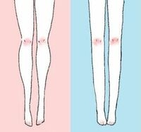 左の足になりたいたいです。右みたいにふくらはぎと太ももが細くて、まっすぐで悩んでます。足自体は細いです。なにすればいいでしょうか？