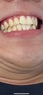 歯が黄色くて悩んでます ただそれだけです 同じように悩んでる人が Yahoo 知恵袋