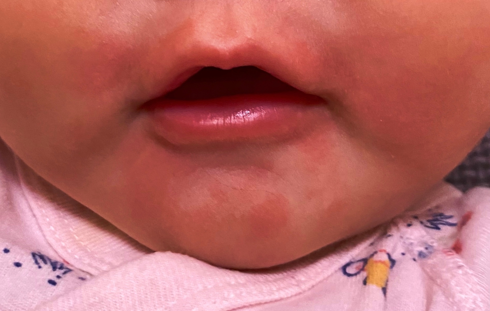 子どもの病気とトラブル すべての質問 Yahoo 知恵袋