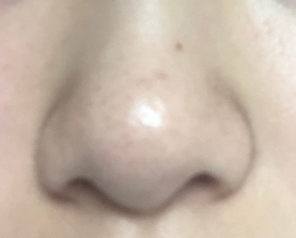 これは何鼻ですか？
