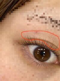 まつげパーマについてなんですが いつもまつげパーマをするとグル Yahoo 知恵袋