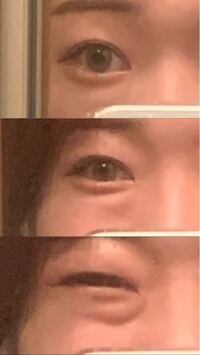 真顔だと涙袋があるのですが 笑うと涙袋より目袋とクマが勝ってしま Yahoo 知恵袋