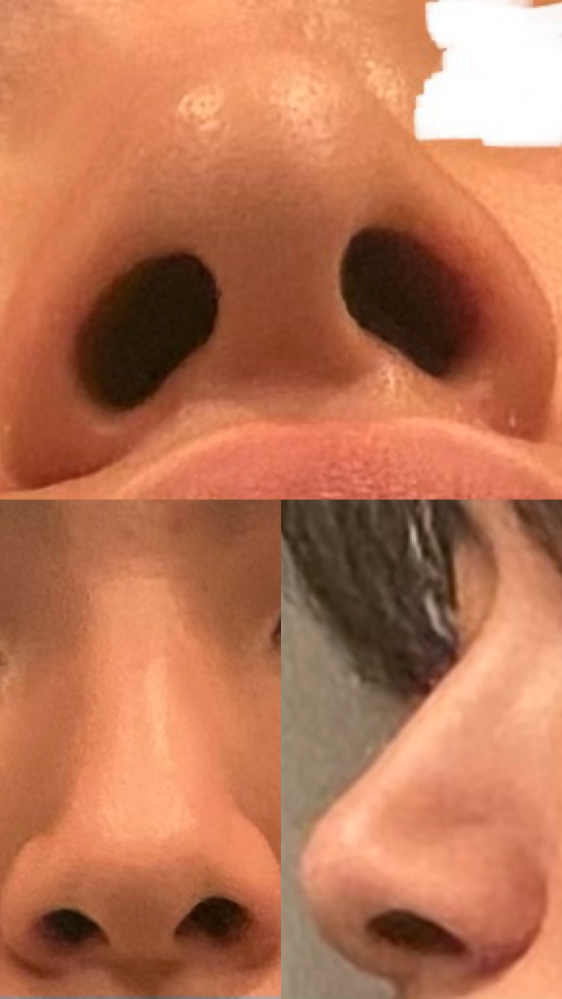 この鼻どうなのか正直に評価してほしいです。