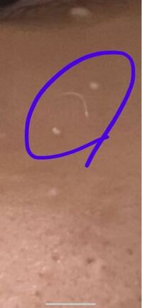 目の下に 透明の白い糸が生えてるんですが 大丈夫ですか Yahoo 知恵袋