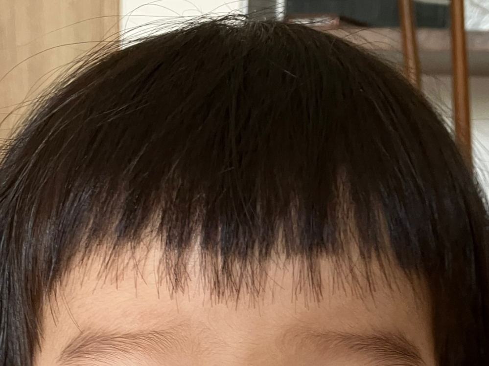 1歳半の子供ですが 前髪をセルフカットしてから伸びる毛と伸びない Yahoo 知恵袋