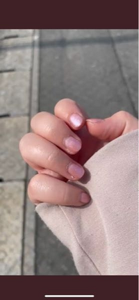 ネイルについて教えてください今は夏ですけど この色はおかしいですか 画像 Yahoo 知恵袋