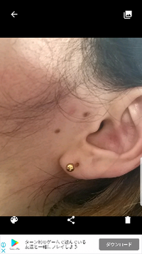 もみあげ付近のほくろなんですが ほくろ占いではどのような意味ですか もしか Yahoo 知恵袋